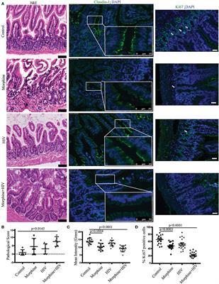 Opioids Impair Intestinal Epithelial Repair in HIV-Infected Humanized Mice